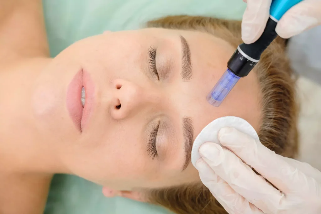 Vivace in Modesto | Access Wellness Services